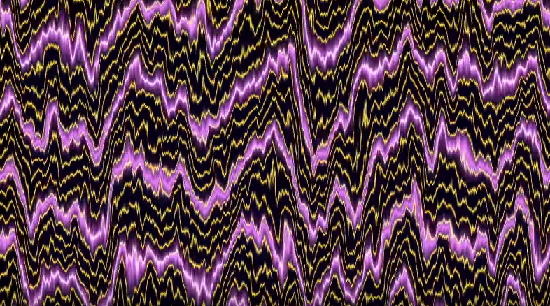 Listen to "Are You Here?" by The Presets