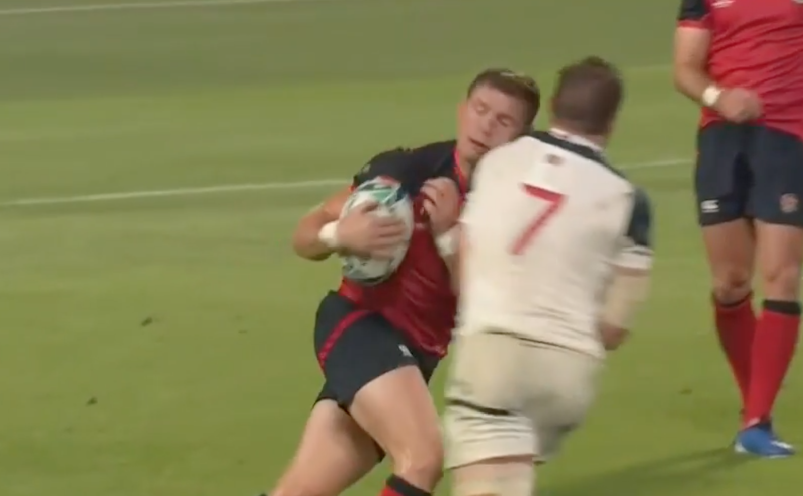 England player "missing half his face" after dangerous hit in game against USA