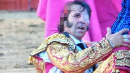 Bull takes a chunk out of one-eyed matador's skull